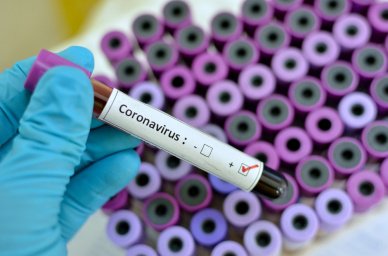 В Киевской области – около тысячи новых случая заболевания коронавирусом. Лидирует по заболеваемости Бучанский район