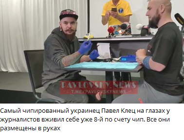 Киевлянин установил рекорд Украины по количеству имплантированных чипов